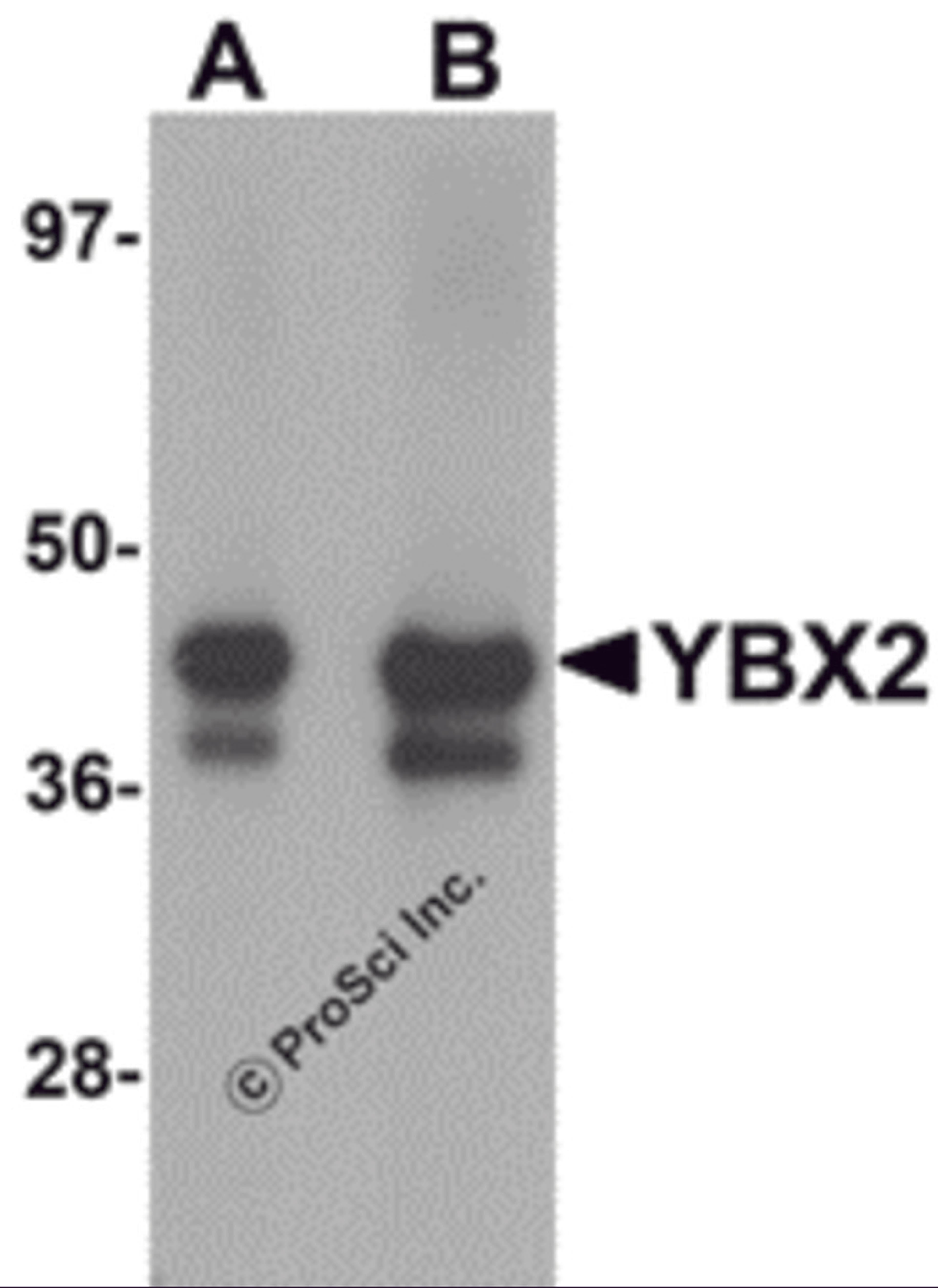 Western blot analysis of YBX2 in human testis tissue lysate with YBX2 antibody at (A) 1 and (B) 2 μg/mL.
