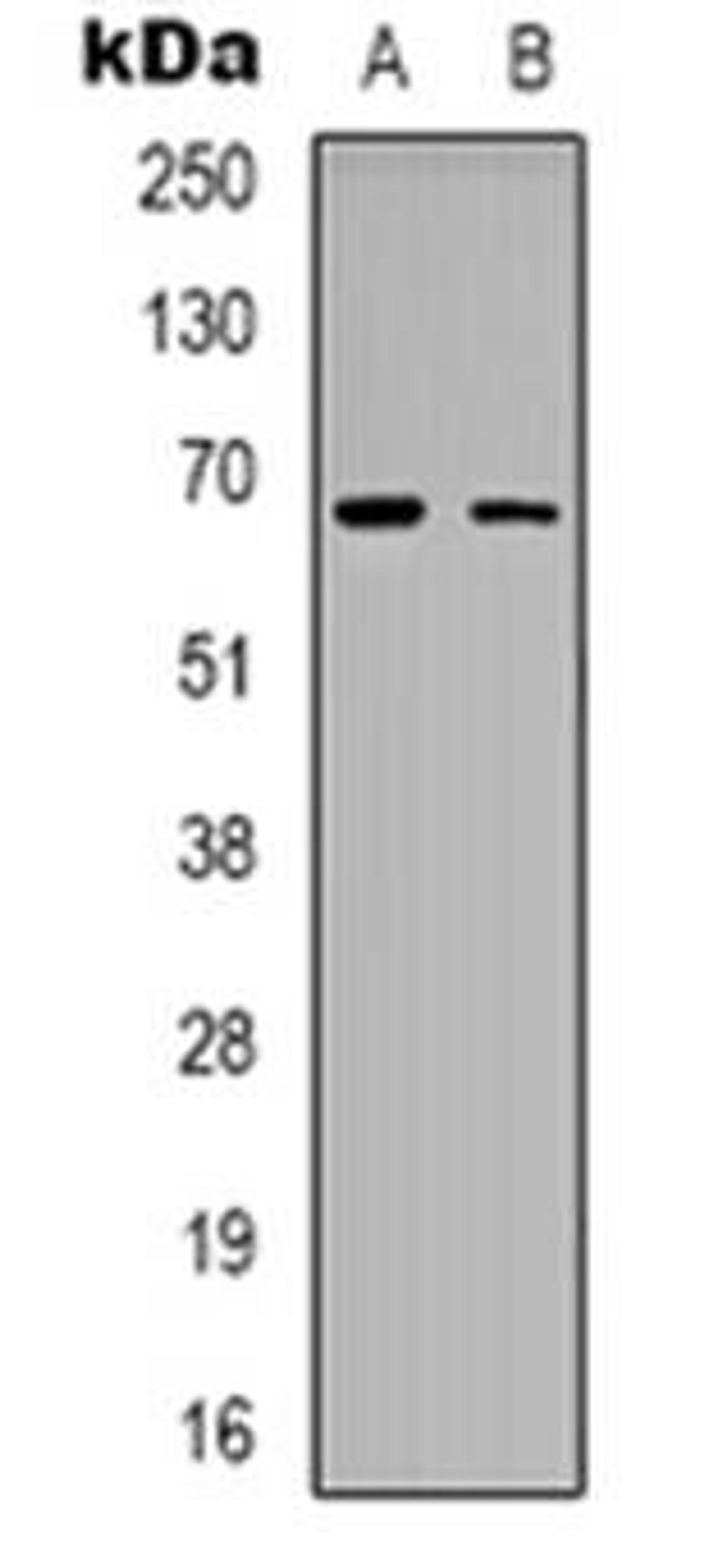 Western blot analysis of ME3 expression in Hela (Lane 1), NIH3T3 (Lane 2) whole cell lysates using ME3 antibody