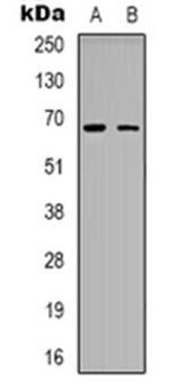 Western blot analysis of ME3 expression in Hela (Lane 1), NIH3T3 (Lane 2) whole cell lysates using ME3 antibody