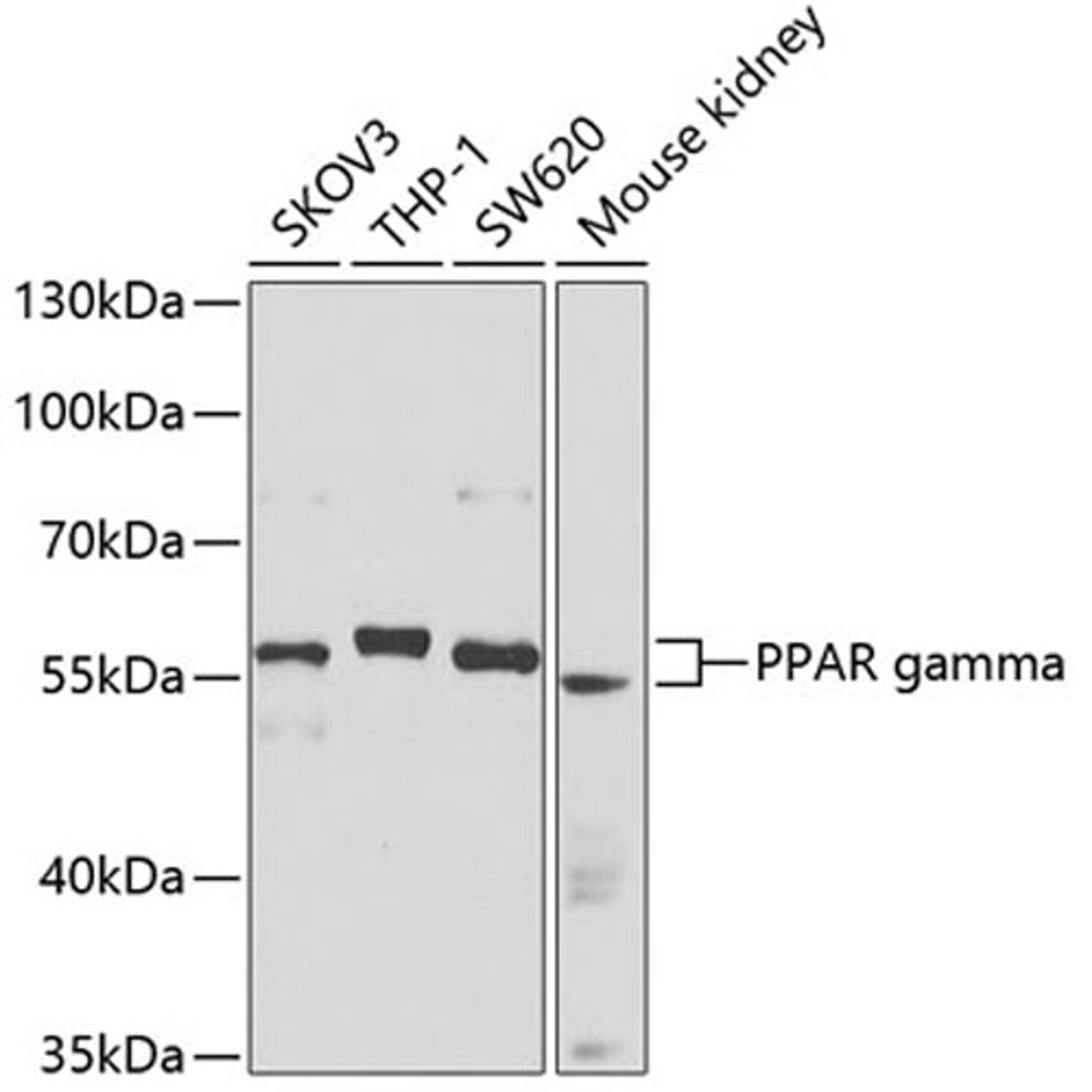 Western blot - PPAR gamma antibody (A0270)