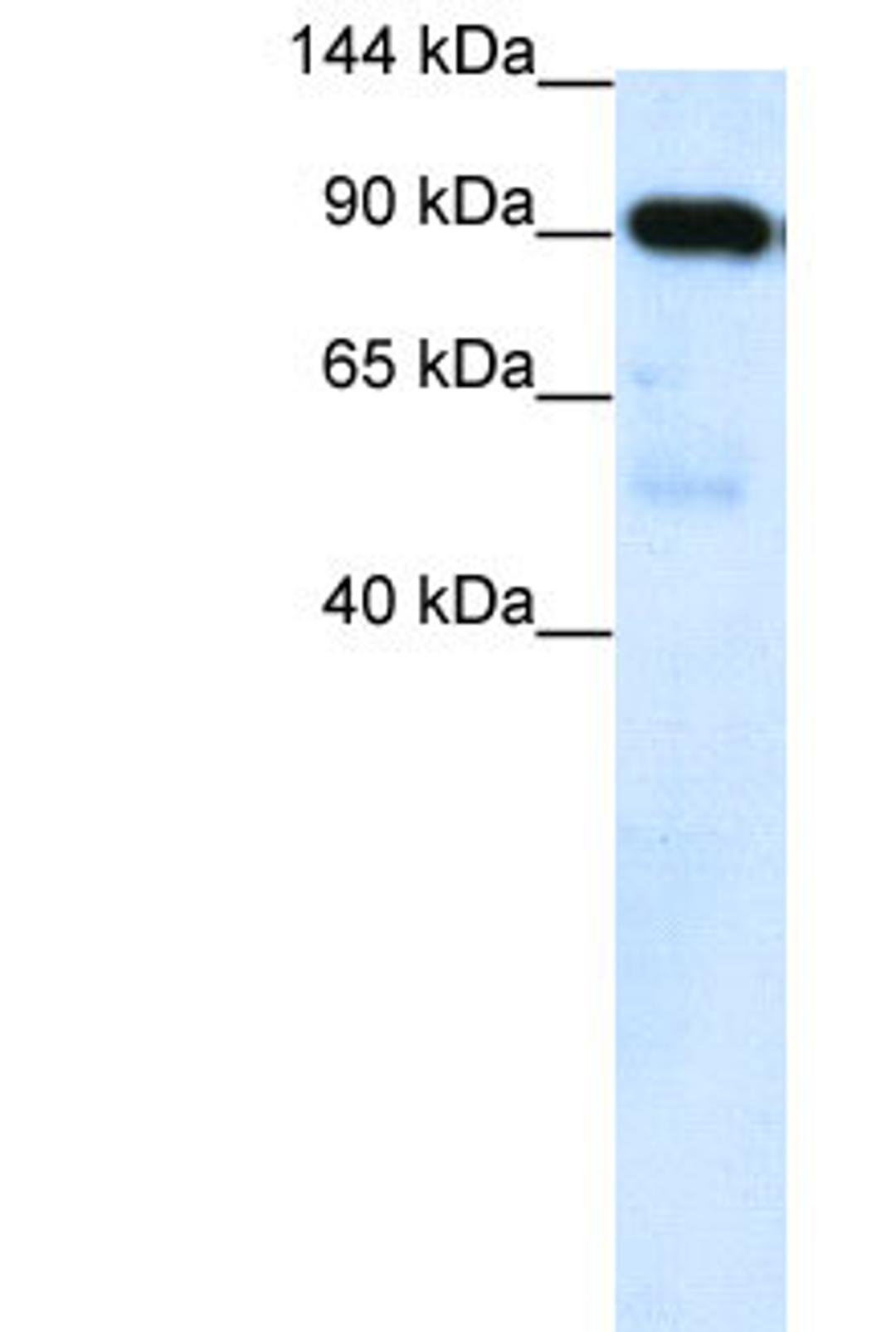 Antibody used in WB on Human Placenta at 0.2-1 ug/ml.