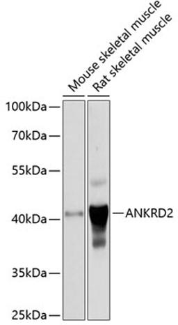 Western blot - ANKRD2 antibody (A4622)