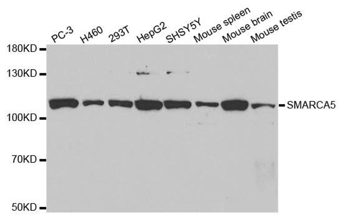 Western blot analysis of extracts of various cell lines using SMARCA5 antibody