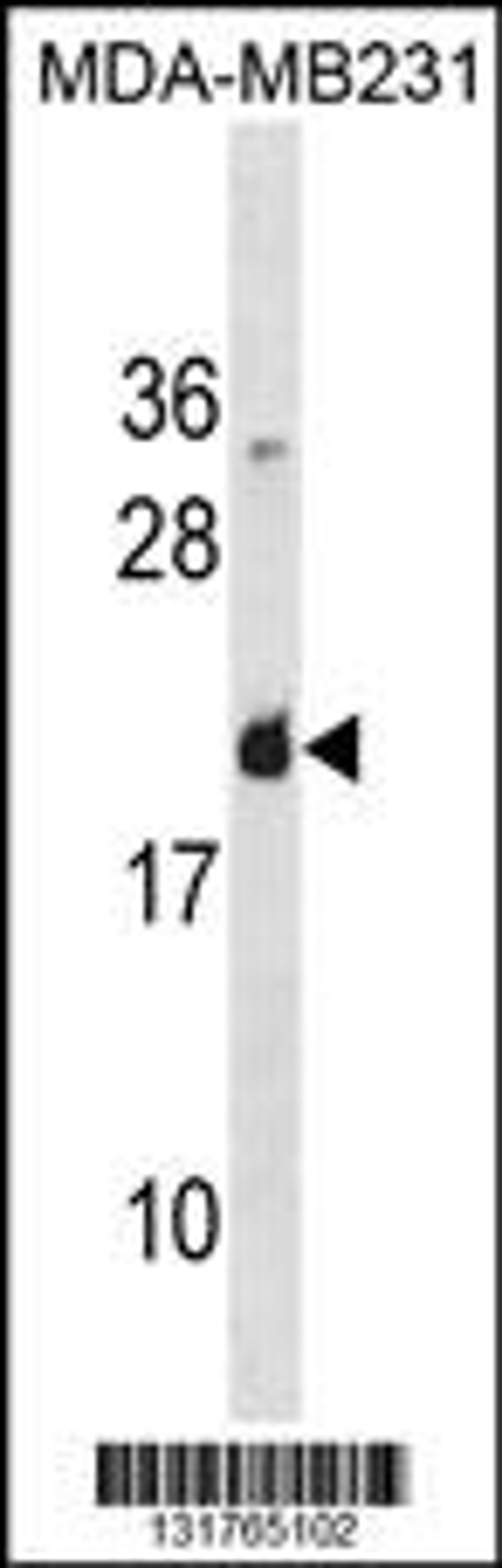 Western blot analysis in MDA-MB231 cell line lysates (35ug/lane).