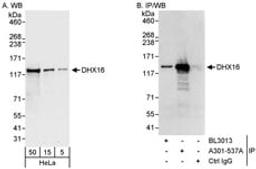 Detection of human DHX16 by western blot and immunoprecipitation.