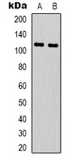 Western blot analysis of NLRP3 expression in SHSY5Y (Lane 1), THP1 (Lane 2) whole cell lysates using NLRP3 antibody