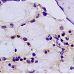 Paraffin-embedded rabbit knee tissue fixed with 4% paraformaldehyde. Antigen retrieval by boiling with citrate buffer. Blocking buffer is goat serum (37 degrees for 20 min.). FGF23 antibody at 1:200 dilution with overnight incubation at 4 degrees