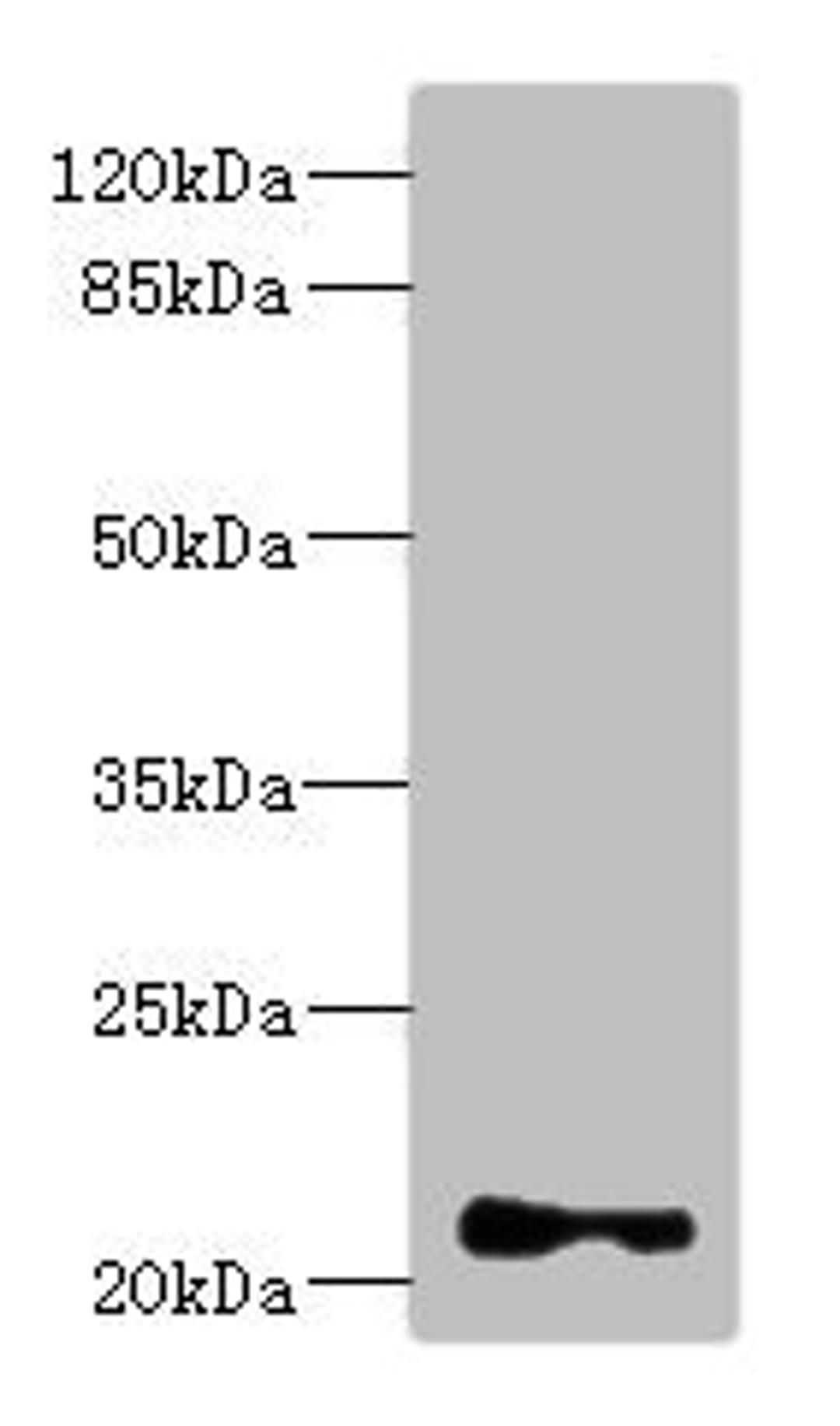 Western blot. All lanes: TNNI2 antibody at 3.83ug/ml + Mouse skeletal muscle tissue. Secondary. Goat polyclonal to rabbit IgG at 1/10000 dilution. Predicted band size: 21 kDa. Observed band size: 21 kDa. 