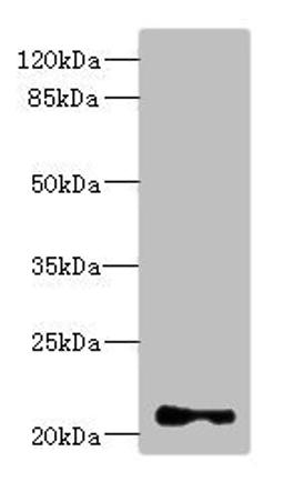 Western blot. All lanes: TNNI2 antibody at 3.83ug/ml + Mouse skeletal muscle tissue. Secondary. Goat polyclonal to rabbit IgG at 1/10000 dilution. Predicted band size: 21 kDa. Observed band size: 21 kDa. 