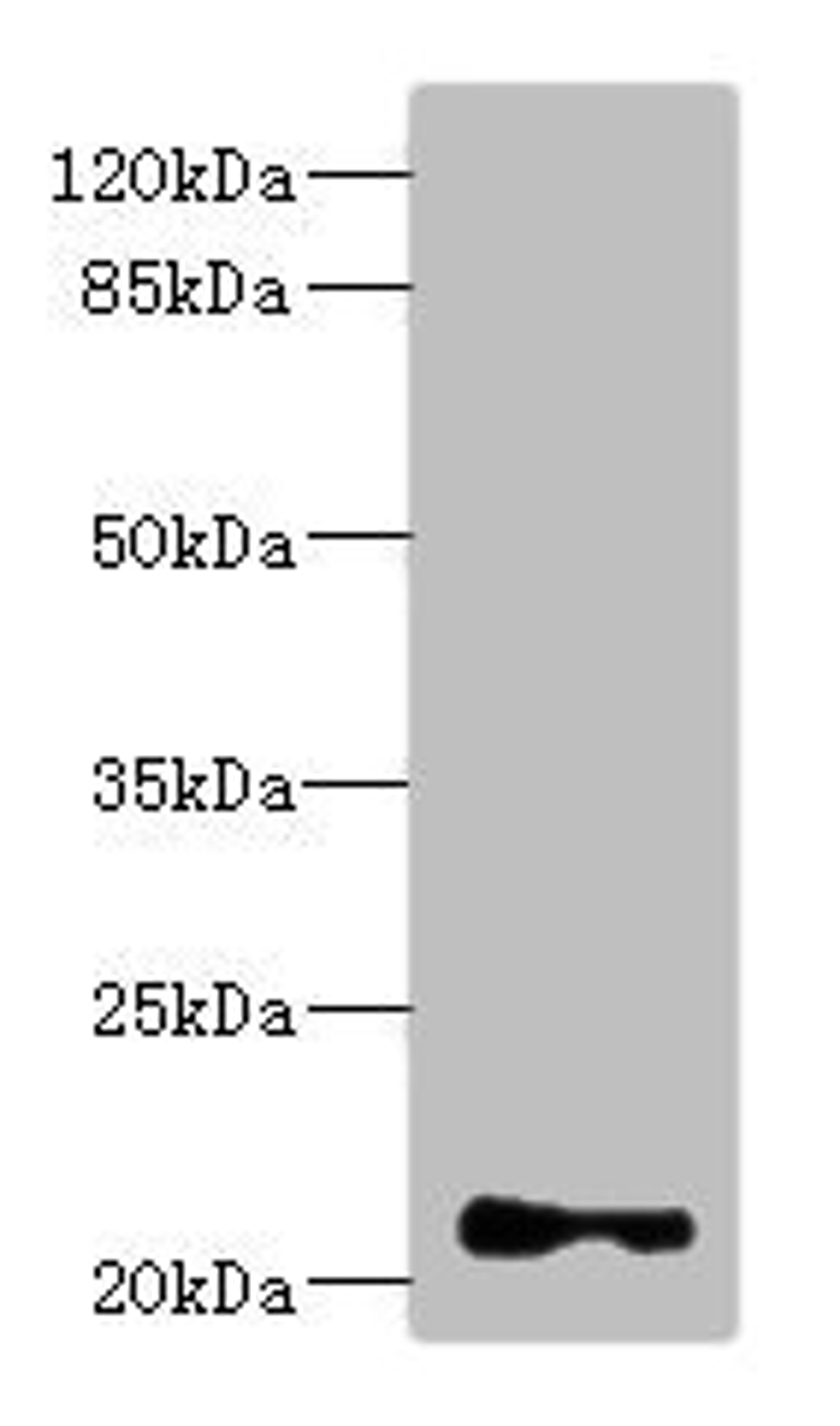 Western blot. All lanes: TNNI2 antibody at 3.83ug/ml + Mouse skeletal muscle tissue. Secondary. Goat polyclonal to rabbit IgG at 1/10000 dilution. Predicted band size: 21 kDa. Observed band size: 21 kDa. 