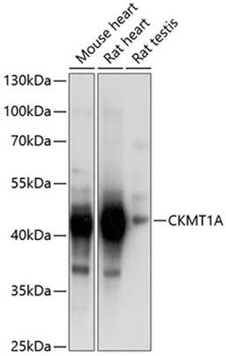 Western blot - CKMT1A Antibody (A5233)