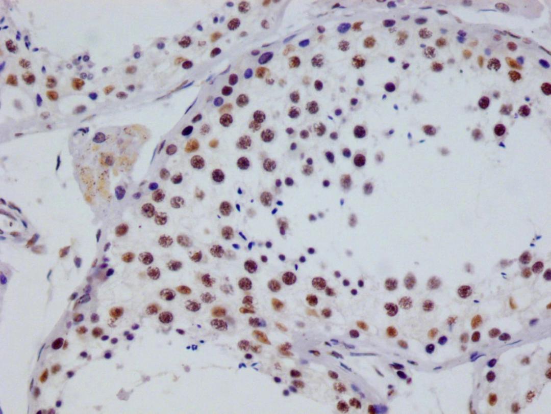 IHC image of CSB-RA253226A0HU diluted at 1:100 and staining in paraffin-embedded human testis tissue performed on a Leica BondTM system. After dewaxing and hydration, antigen retrieval was mediated by high pressure in a citrate buffer (pH 6.0). Section was blocked with 10% normal goat serum 30min at RT. Then primary antibody (1% BSA) was incubated at 4°C overnight. The primary is detected by a Goat anti-rabbit polymer IgG labeled by HRP and visualized using 0.05% DAB.