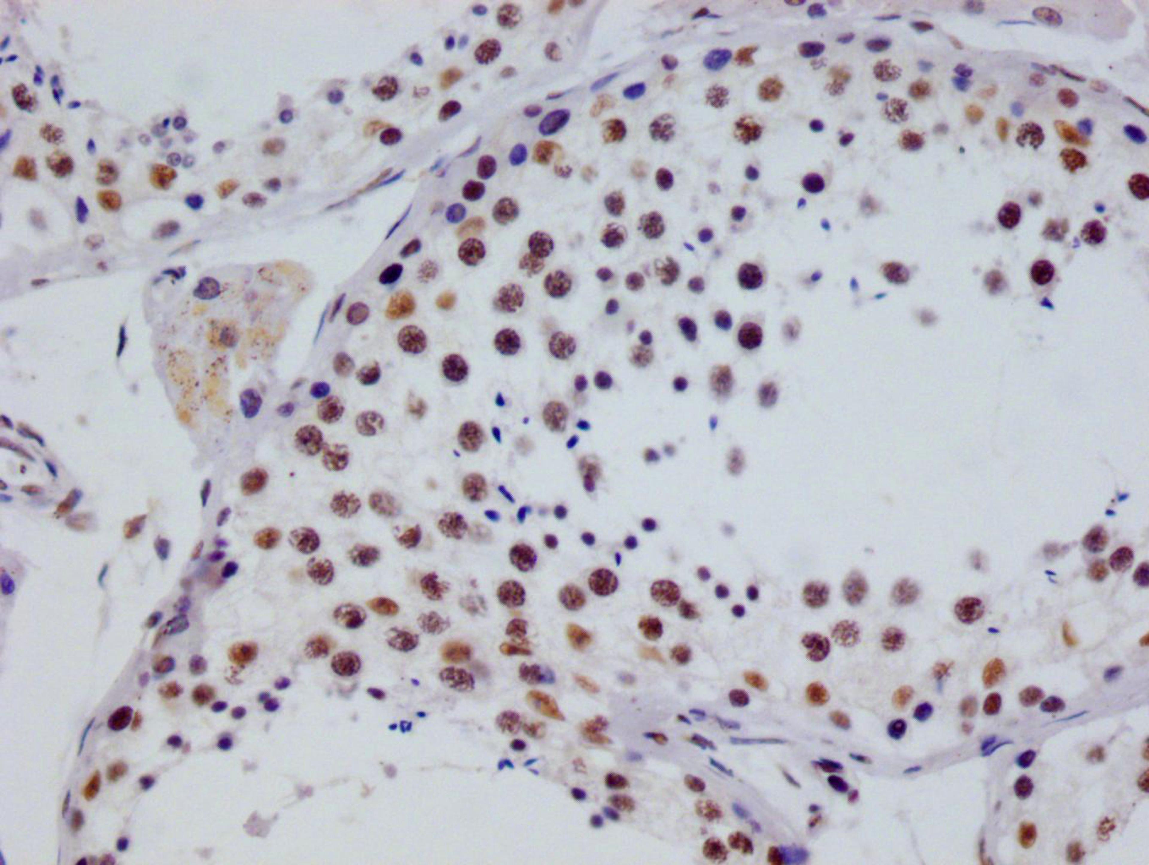 IHC image of CSB-RA253226A0HU diluted at 1:100 and staining in paraffin-embedded human testis tissue performed on a Leica BondTM system. After dewaxing and hydration, antigen retrieval was mediated by high pressure in a citrate buffer (pH 6.0). Section was blocked with 10% normal goat serum 30min at RT. Then primary antibody (1% BSA) was incubated at 4°C overnight. The primary is detected by a Goat anti-rabbit polymer IgG labeled by HRP and visualized using 0.05% DAB.