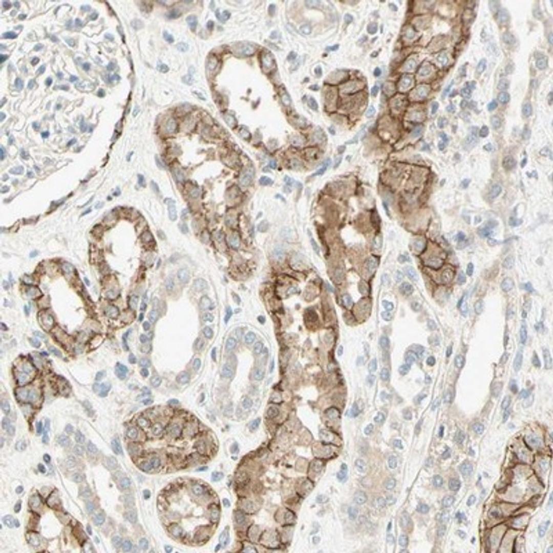 Immunohistochemistry-Paraffin: K Cadherin Antibody [NBP1-87588] - Staining of human kidney shows distinct membranous positivity in cells in tubules.