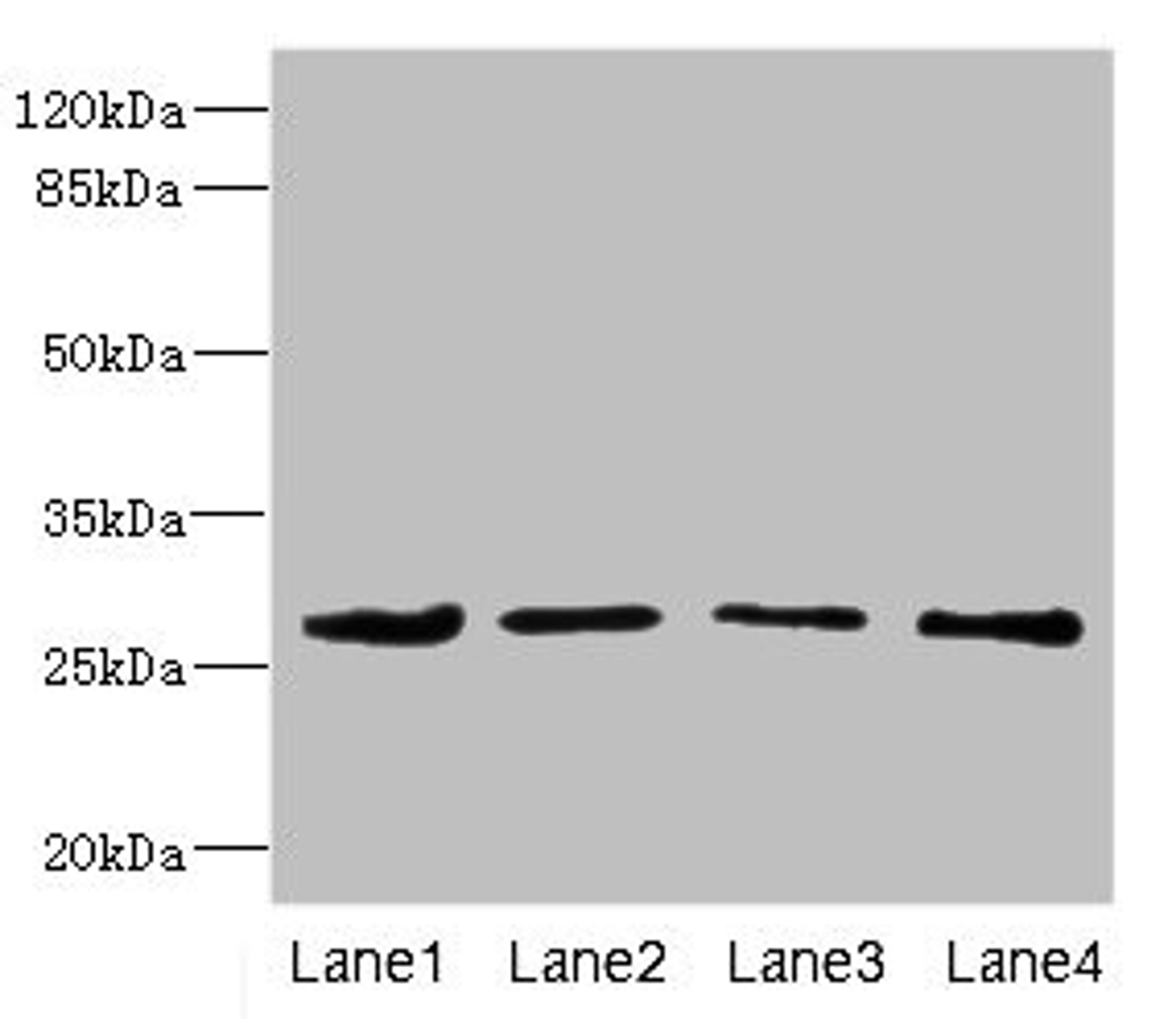 Western blot. All lanes: DCXR antibody at 2.93ug/ml. Lane 1: Mouse gonadal tissue. Lane 2: HepG2 whole cell lysate. Lane 3: A431 whole cell lysate. Lane 4: MCF-7 whole cell lysate. Secondary. Goat polyclonal to rabbit IgG at 1/10000 dilution. Predicted band size: 26 kDa. Observed band size: 26 kDa. 
