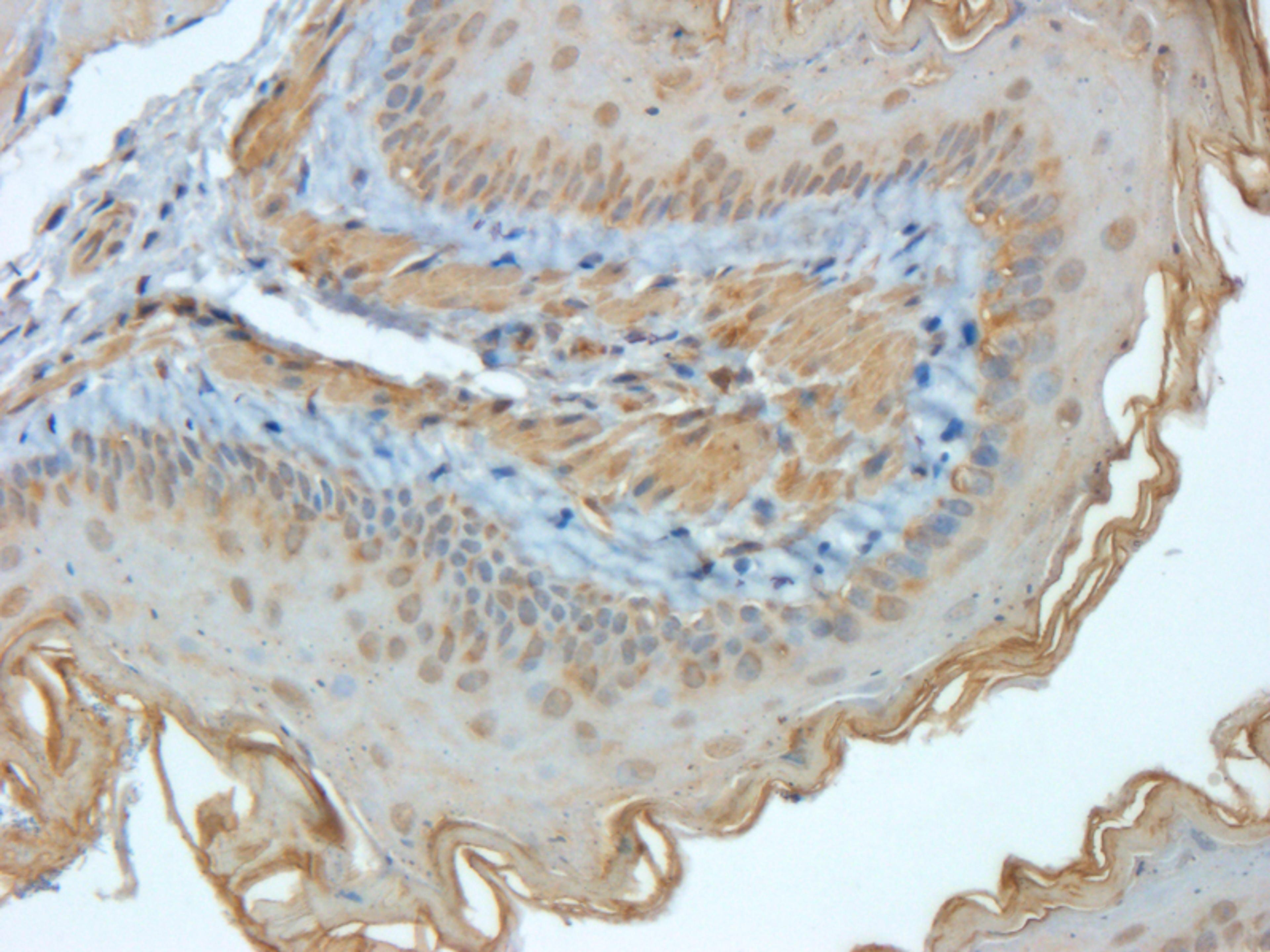 Immunohistochemical staining of mouse lung tissue using EpCAM antibody (2.5 ug/ml)