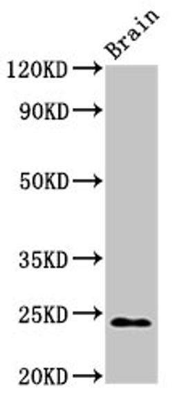 Western Blot. Positive WB detected in: Rat brain tissue. All lanes: NDUFS8 antibody at 2.7ug/ml. Secondary. Goat polyclonal to rabbit IgG at 1/50000 dilution. Predicted band size: 24 kDa. Observed band size: 24 kDa. 
