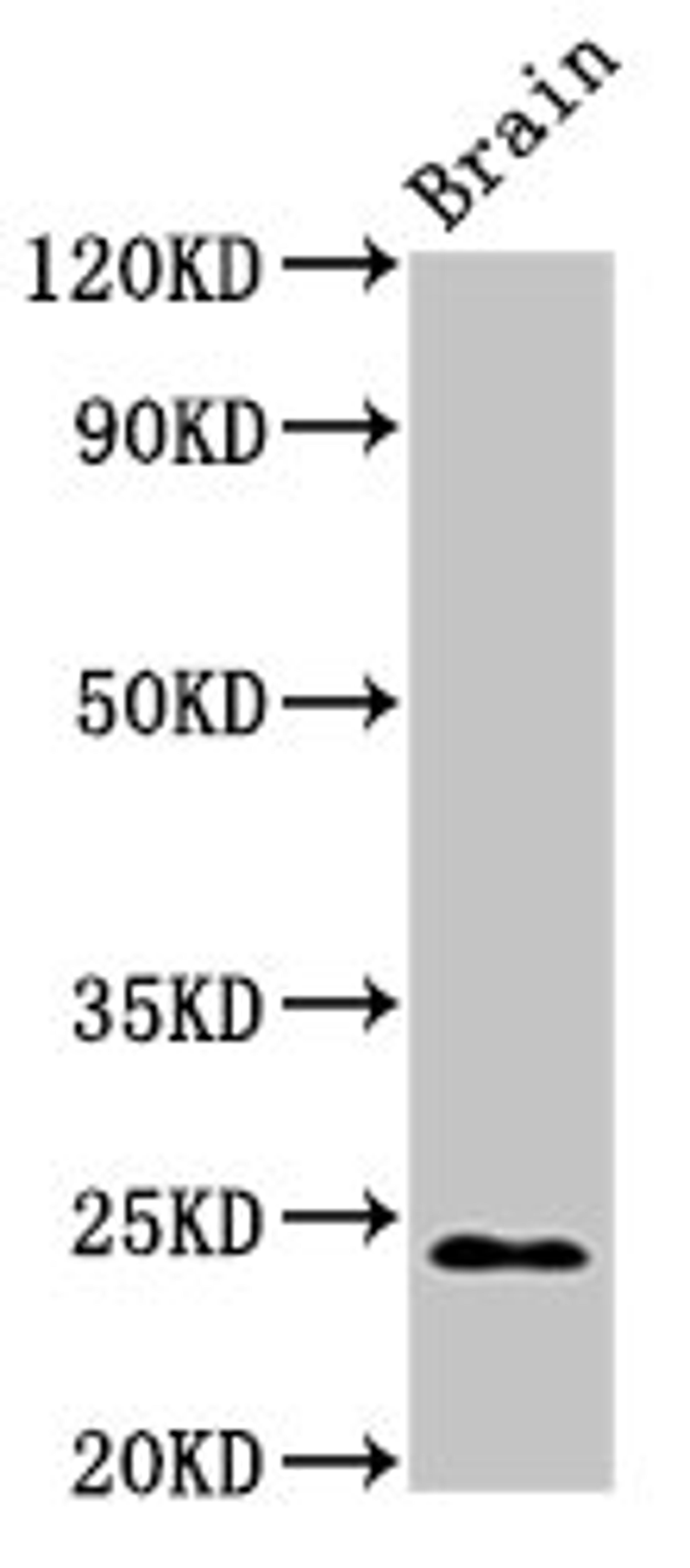 Western Blot. Positive WB detected in: Rat brain tissue. All lanes: NDUFS8 antibody at 2.7ug/ml. Secondary. Goat polyclonal to rabbit IgG at 1/50000 dilution. Predicted band size: 24 kDa. Observed band size: 24 kDa. 
