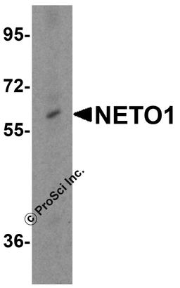 Western blot analysis of NETO1 in human brain tissue lysate with NETO1 antibody at 0.25 μg/mL.