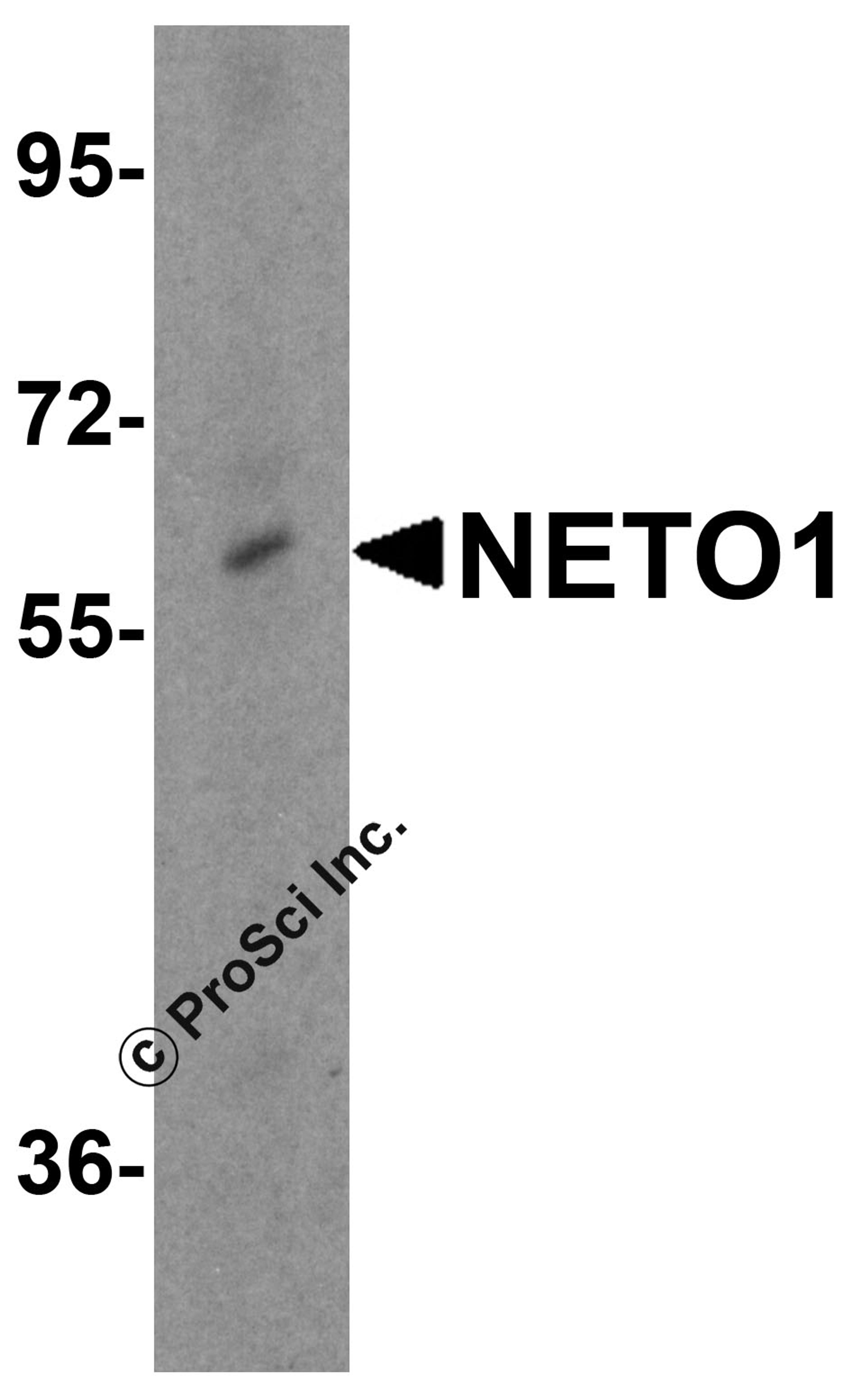 Western blot analysis of NETO1 in human brain tissue lysate with NETO1 antibody at 0.25 μg/mL.