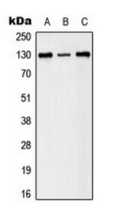 Western blot analysis of A431 (Lane 1), HeLa (Lane 2), NIH3T3 (Lane 3) whole cell lysates using EPHB1/2 (phospho-Y594/604) antibody