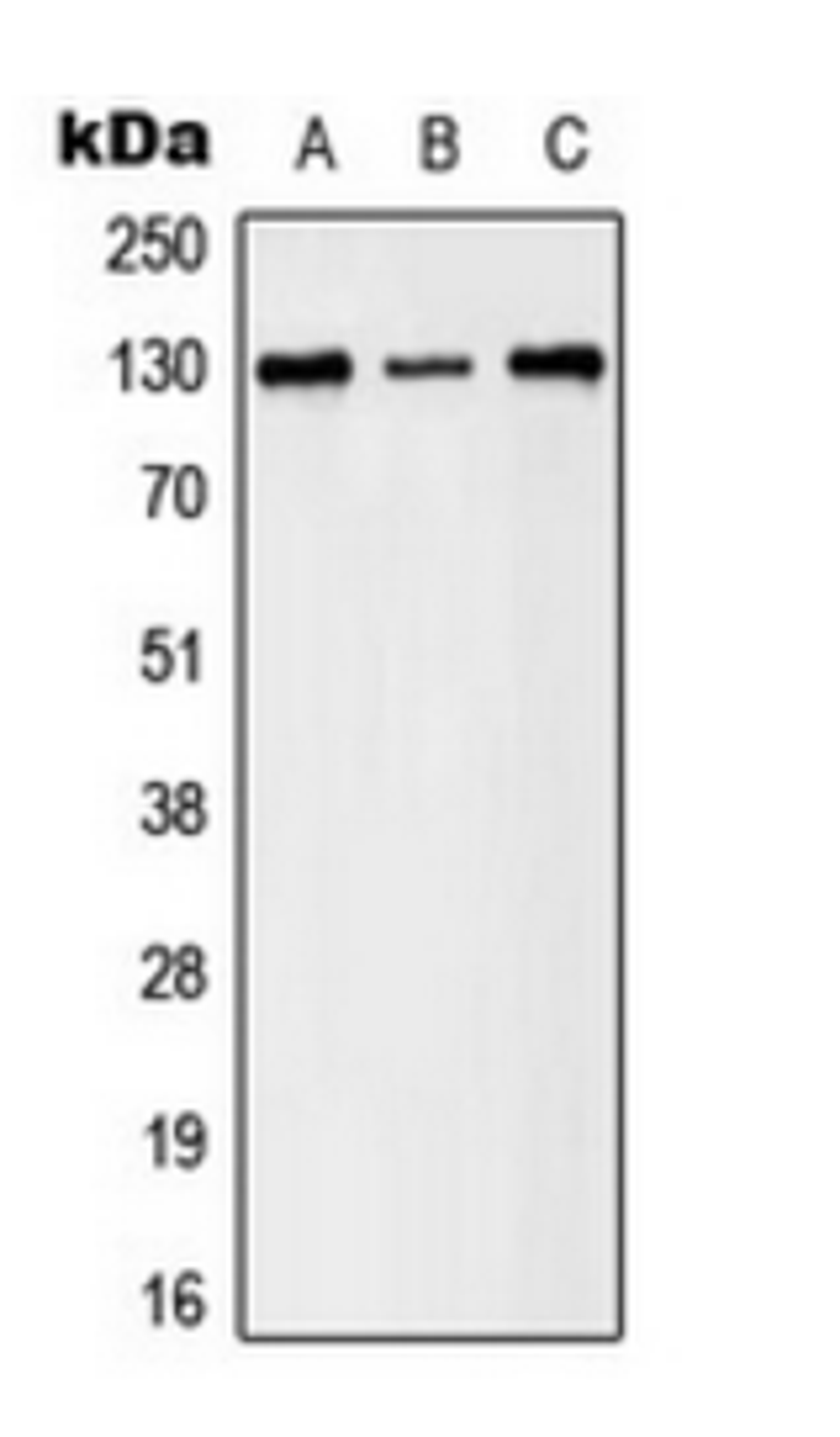 Western blot analysis of A431 (Lane 1), HeLa (Lane 2), NIH3T3 (Lane 3) whole cell lysates using EPHB1/2 (phospho-Y594/604) antibody