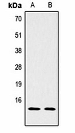 Western blot analysis of Hela (Lane1), NIH3T3 (Lane2) whole cell lysates using Histone H2B (DiMethyl K5) antibody