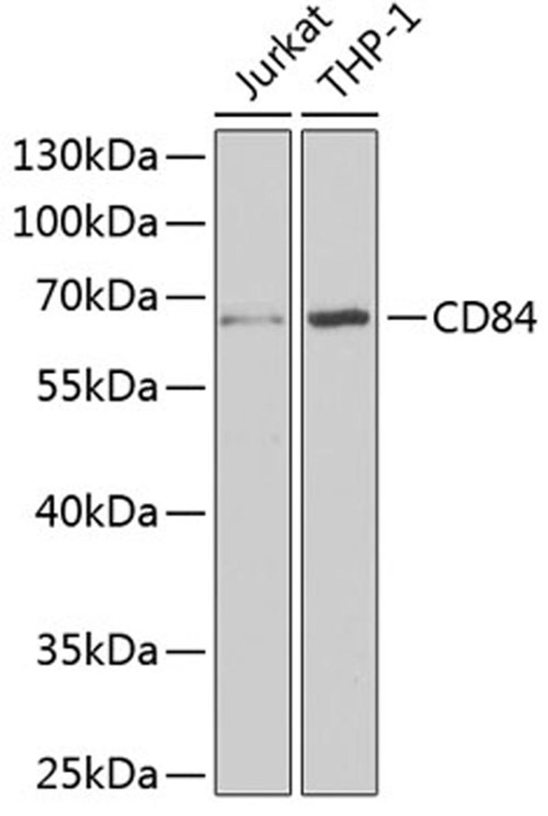 Western blot - CD84 antibody (A6433)