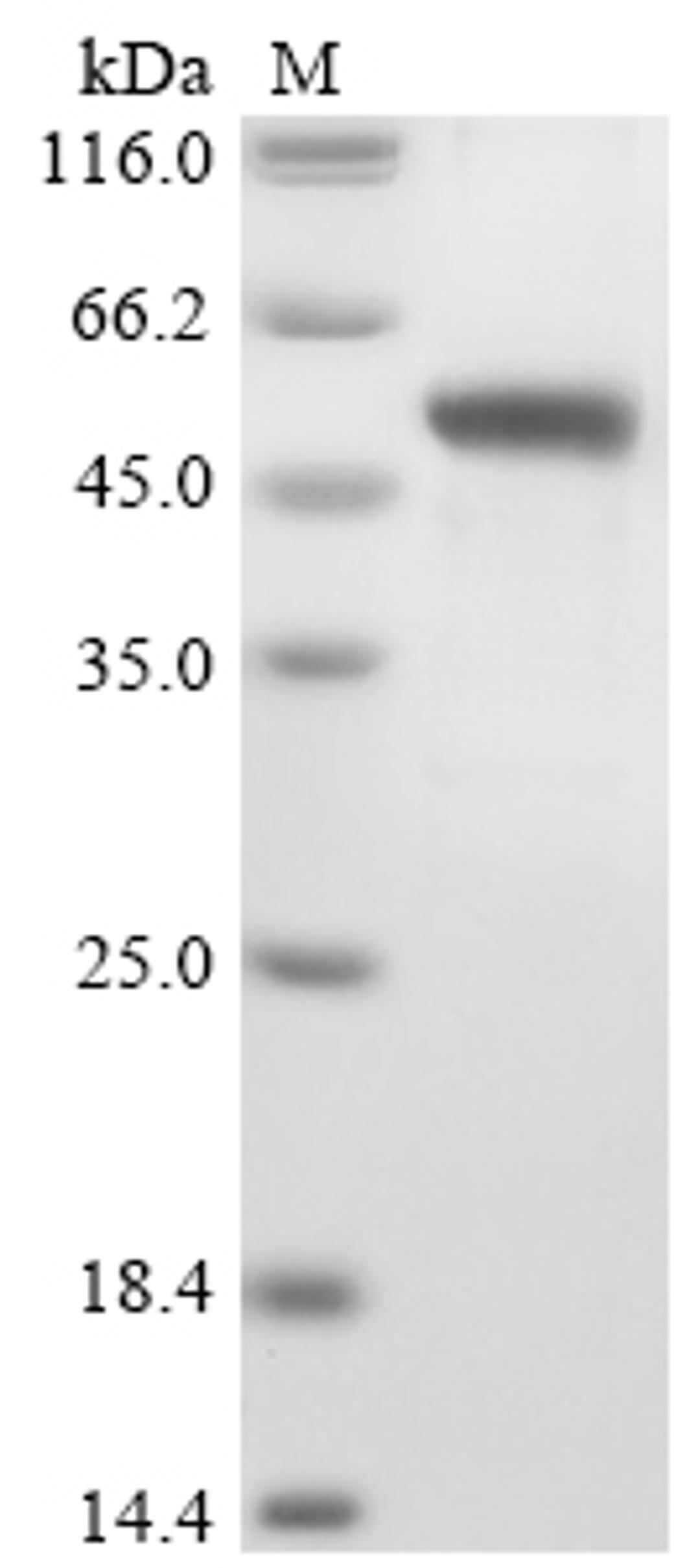 (Tris-Glycine gel) Discontinuous SDS-PAGE (reduced) with 5% enrichment gel and 15% separation gel.
