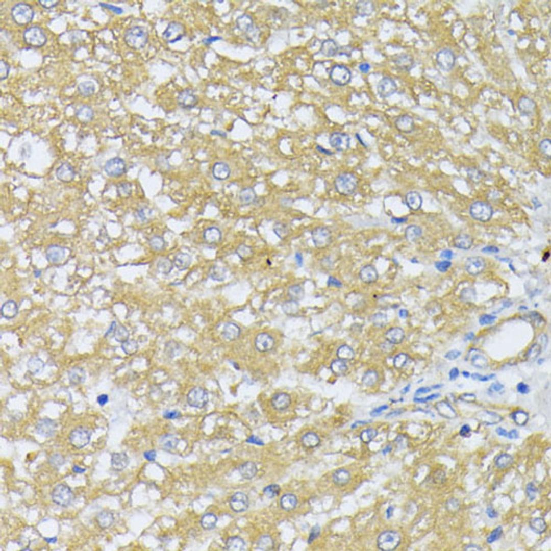 Immunohistochemistry - PRDX4 antibody (A18308)
