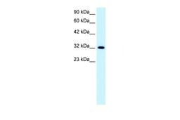 Antibody used in WB on Human Jurkat 0.2-1 ug/ml.