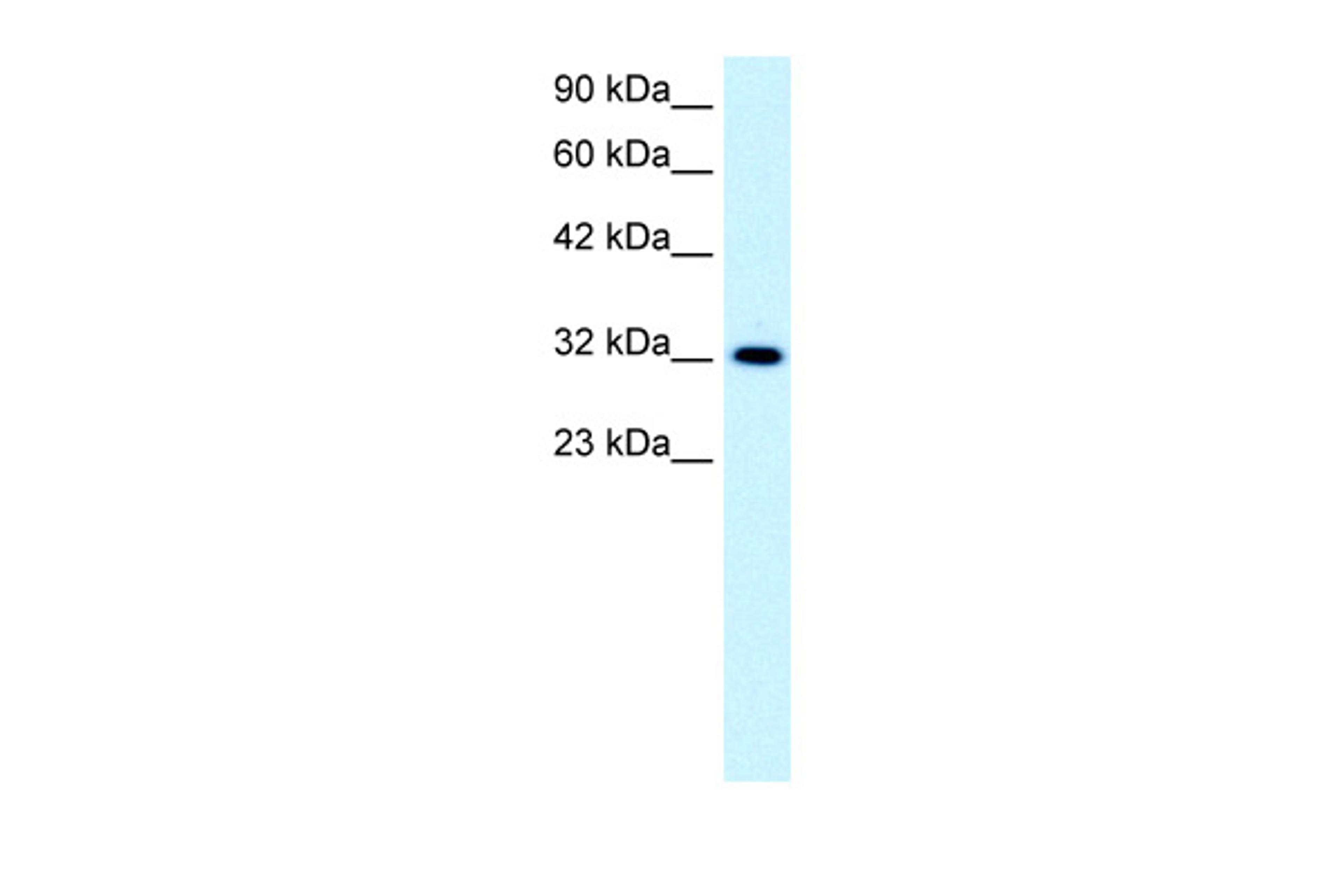 Antibody used in WB on Human Jurkat 0.2-1 ug/ml.