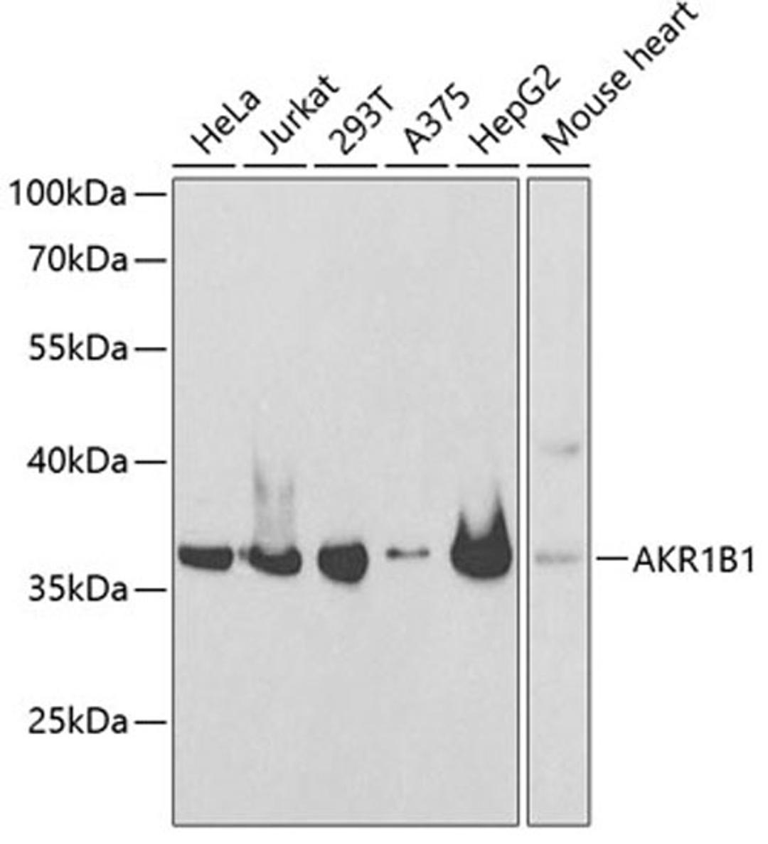 Western blot - AKR1B1 antibody (A13944)