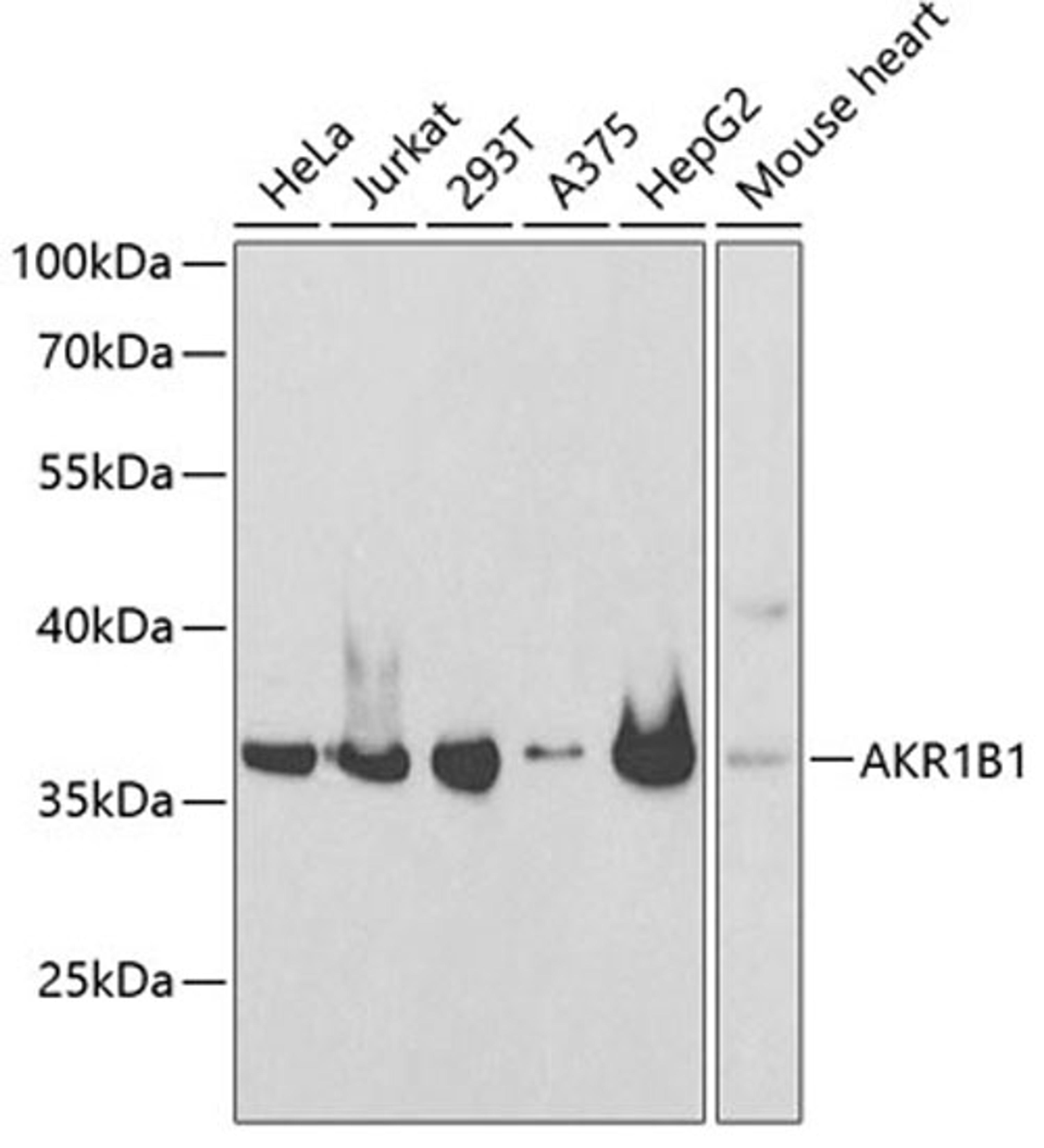 Western blot - AKR1B1 antibody (A13944)