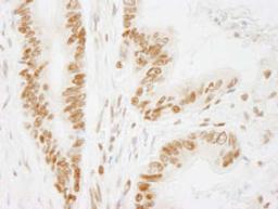 Detection of human ACINUS/ACIN1 by immunohistochemistry.