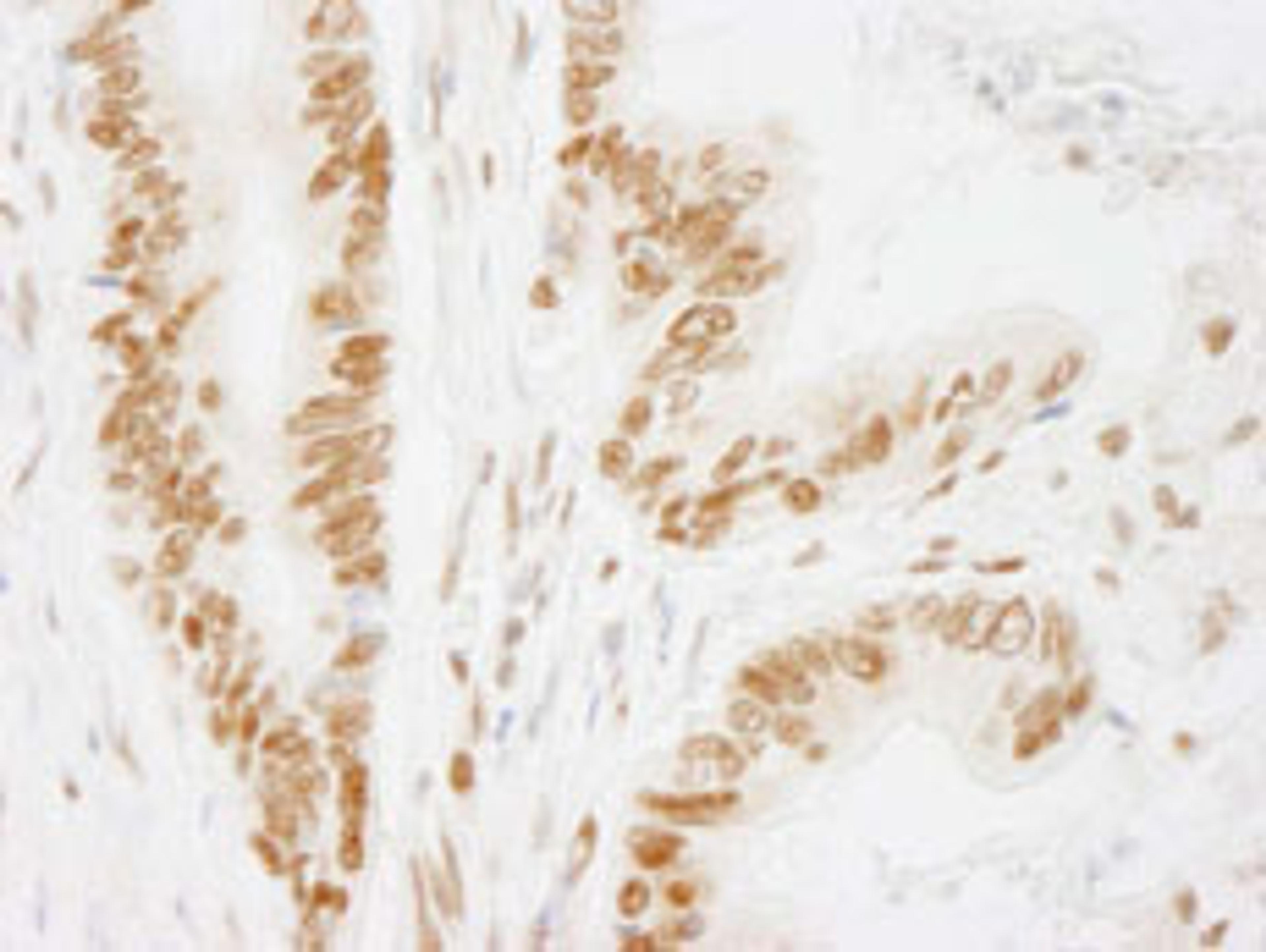 Detection of human ACINUS/ACIN1 by immunohistochemistry.