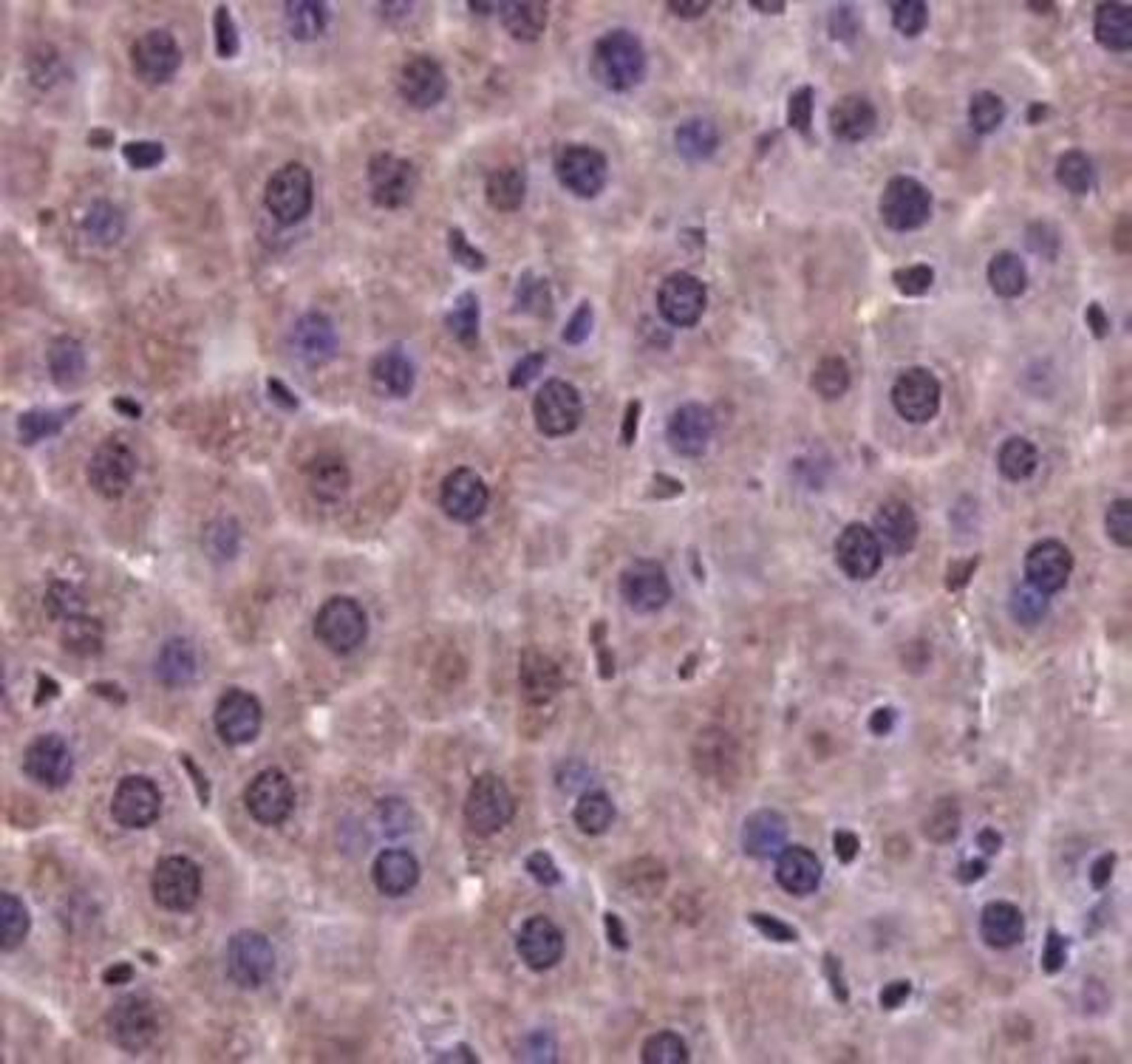 Immunohistochemical staining of mouse liver tissue using PRMT5 antibody