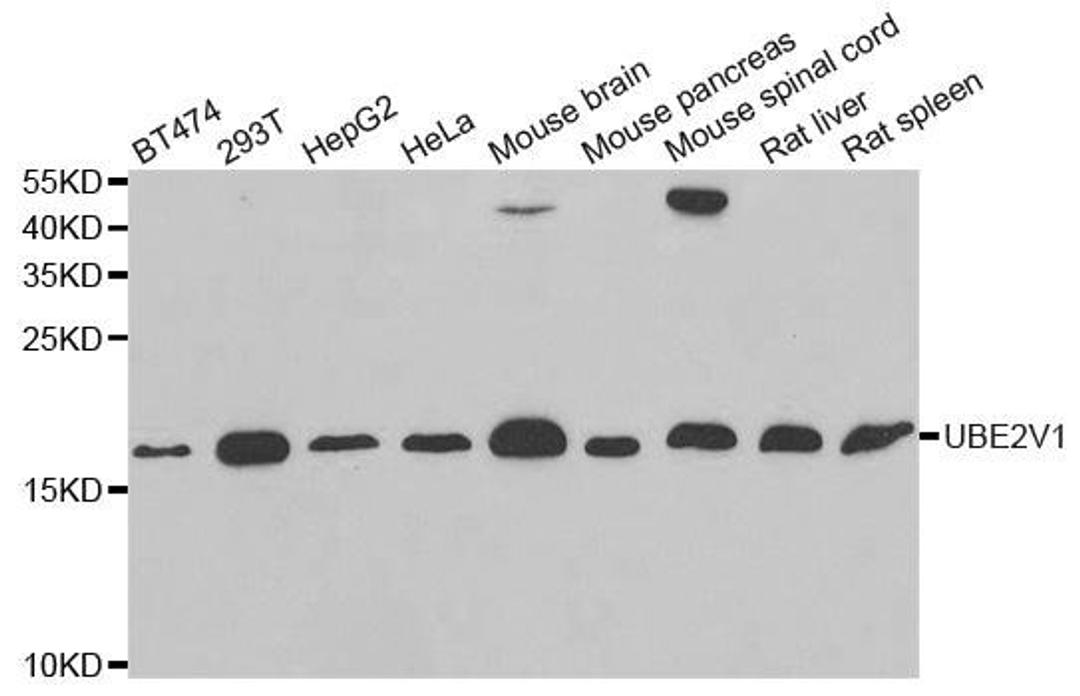 Western blot analysis of extracts of various cell lines using UBE2V1 antibody