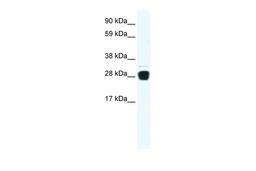 Antibody used in WB on Human Muscle at 0.2-1 ug/ml.