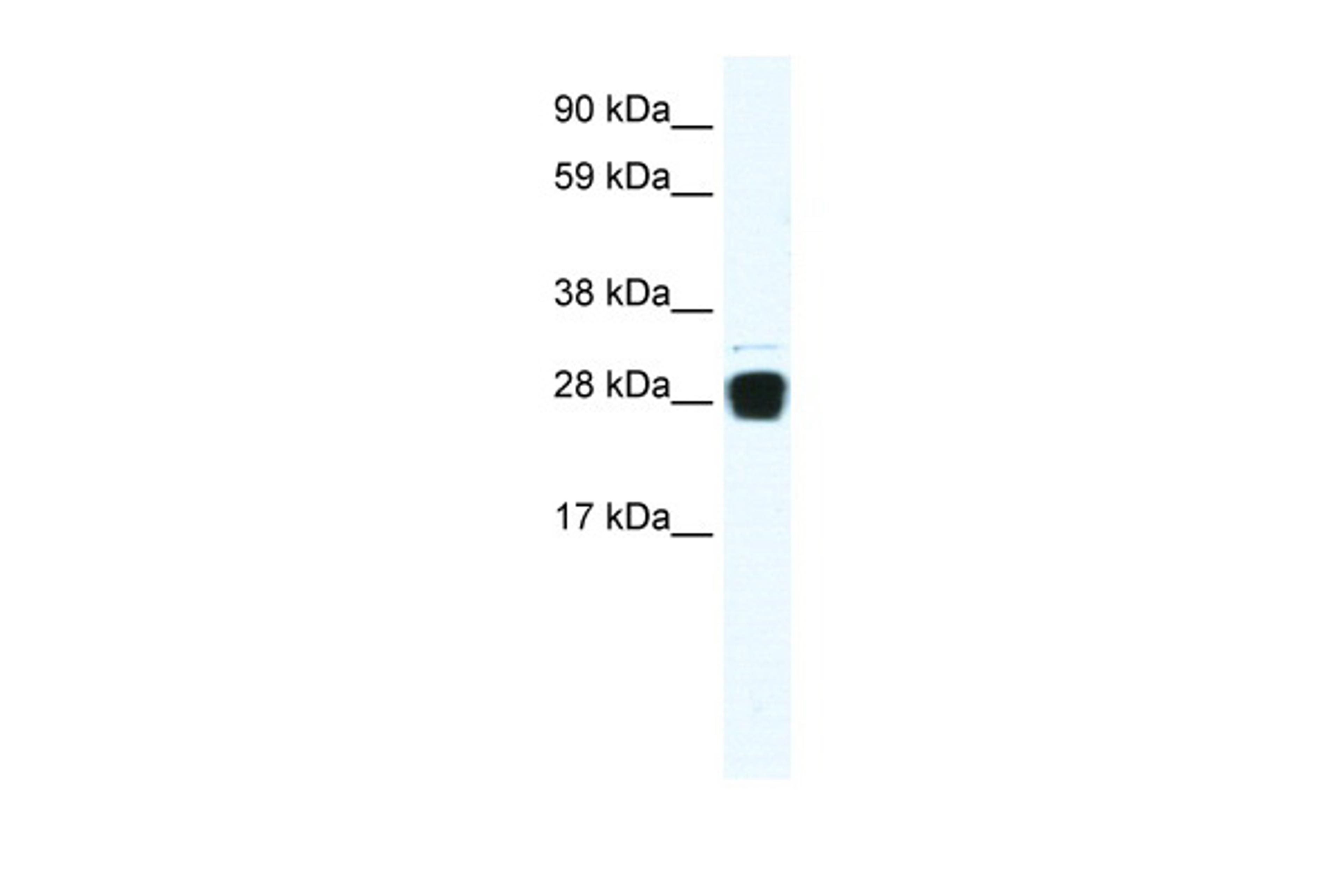 Antibody used in WB on Human Muscle at 0.2-1 ug/ml.