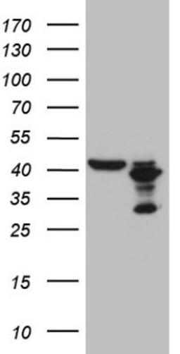 Western Blot: PLCXD1 Antibody (2D7) [NBP2-46442] - Analysis of HEK293T cells were transfected with the pCMV6-ENTRY control (Left lane) or pCMV6-ENTRY PLCXD1.