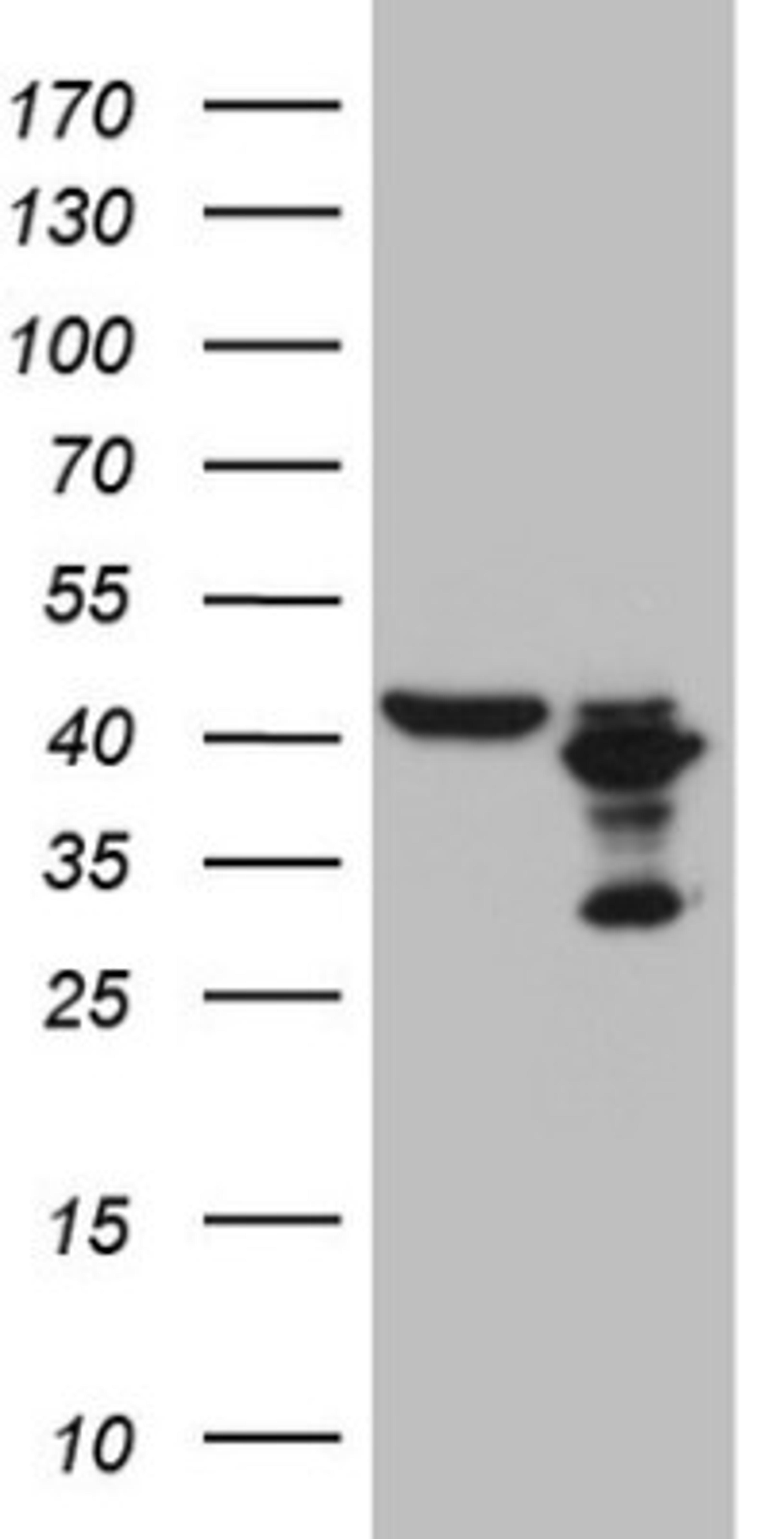 Western Blot: PLCXD1 Antibody (2D7) [NBP2-46442] - Analysis of HEK293T cells were transfected with the pCMV6-ENTRY control (Left lane) or pCMV6-ENTRY PLCXD1.