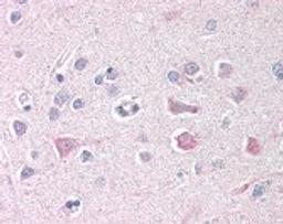 Immunohistochemistry staining of ISG15 in brain cortex tissue using ISG15 Antibody.