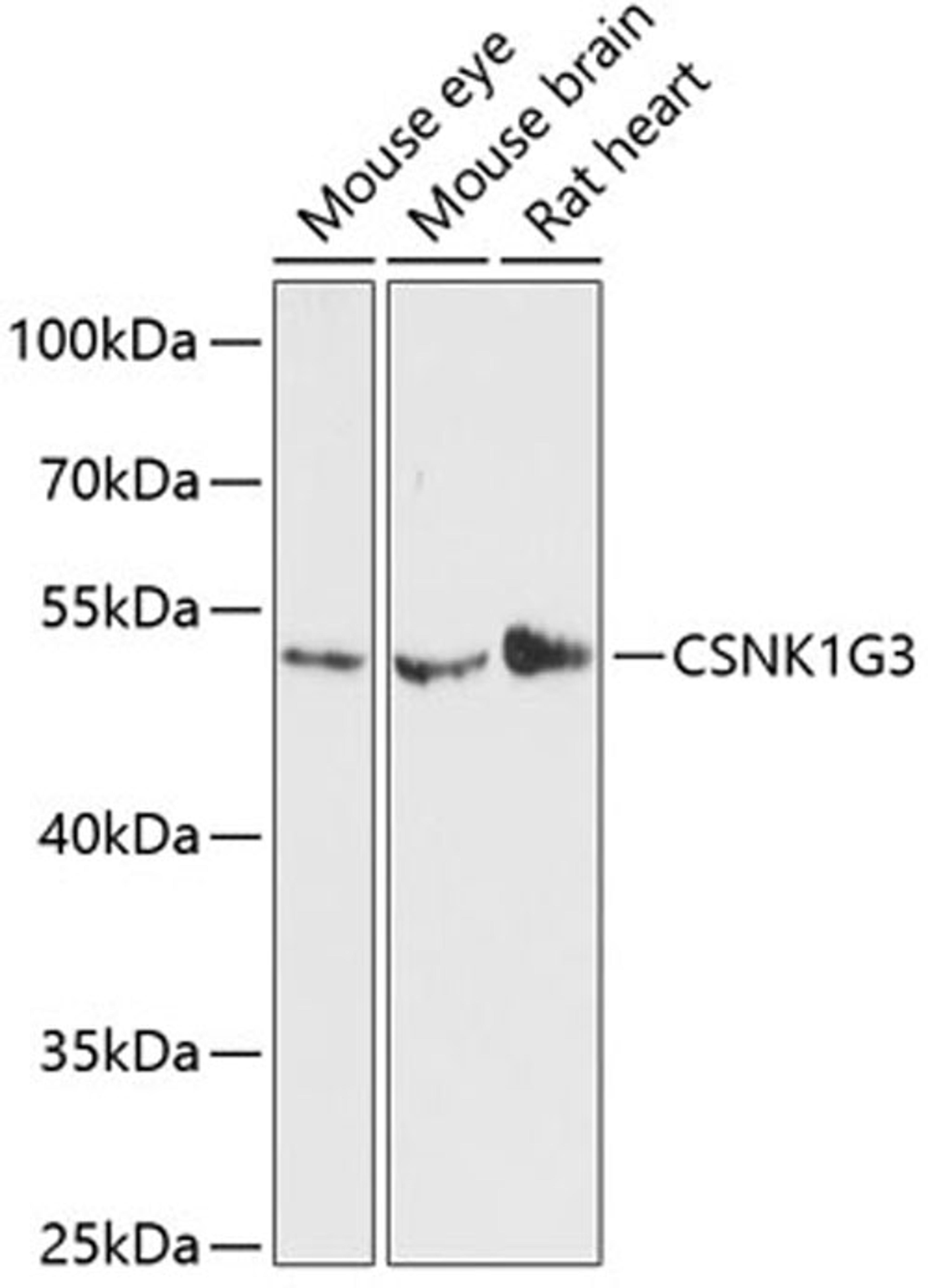 Western blot - CSNK1G3 antibody (A13013)