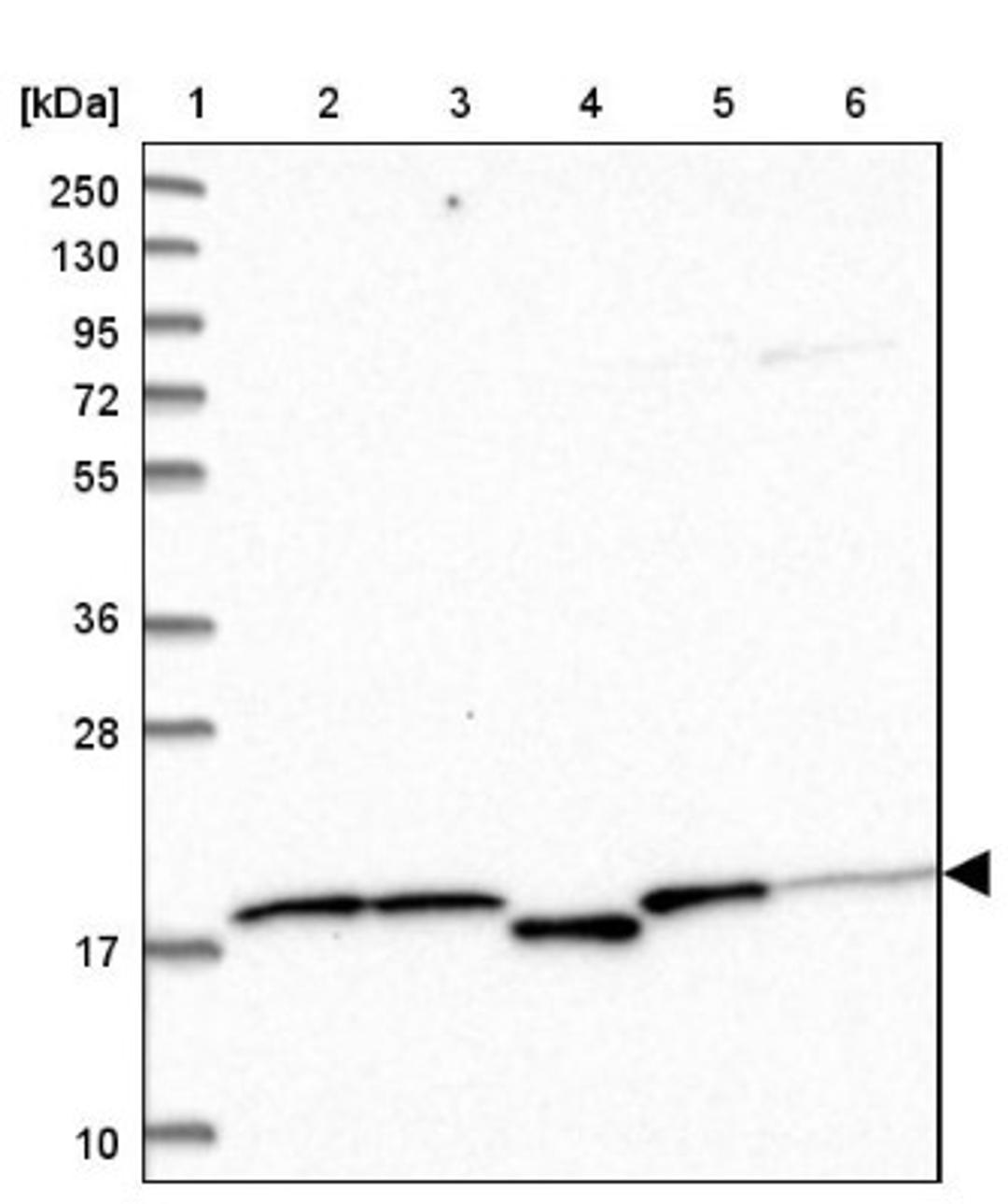 Western Blot: Sentan Antibody [NBP1-92378] - Lane 1: Marker [kDa] 250, 130, 95, 72, 55, 36, 28, 17, 10<br/>Lane 2: Human cell line RT-4<br/>Lane 3: Human cell line U-251MG sp<br/>Lane 4: Human plasma (IgG/HSA depleted)<br/>Lane 5: Human liver tissue<br/>Lane 6: Human tonsil tissue