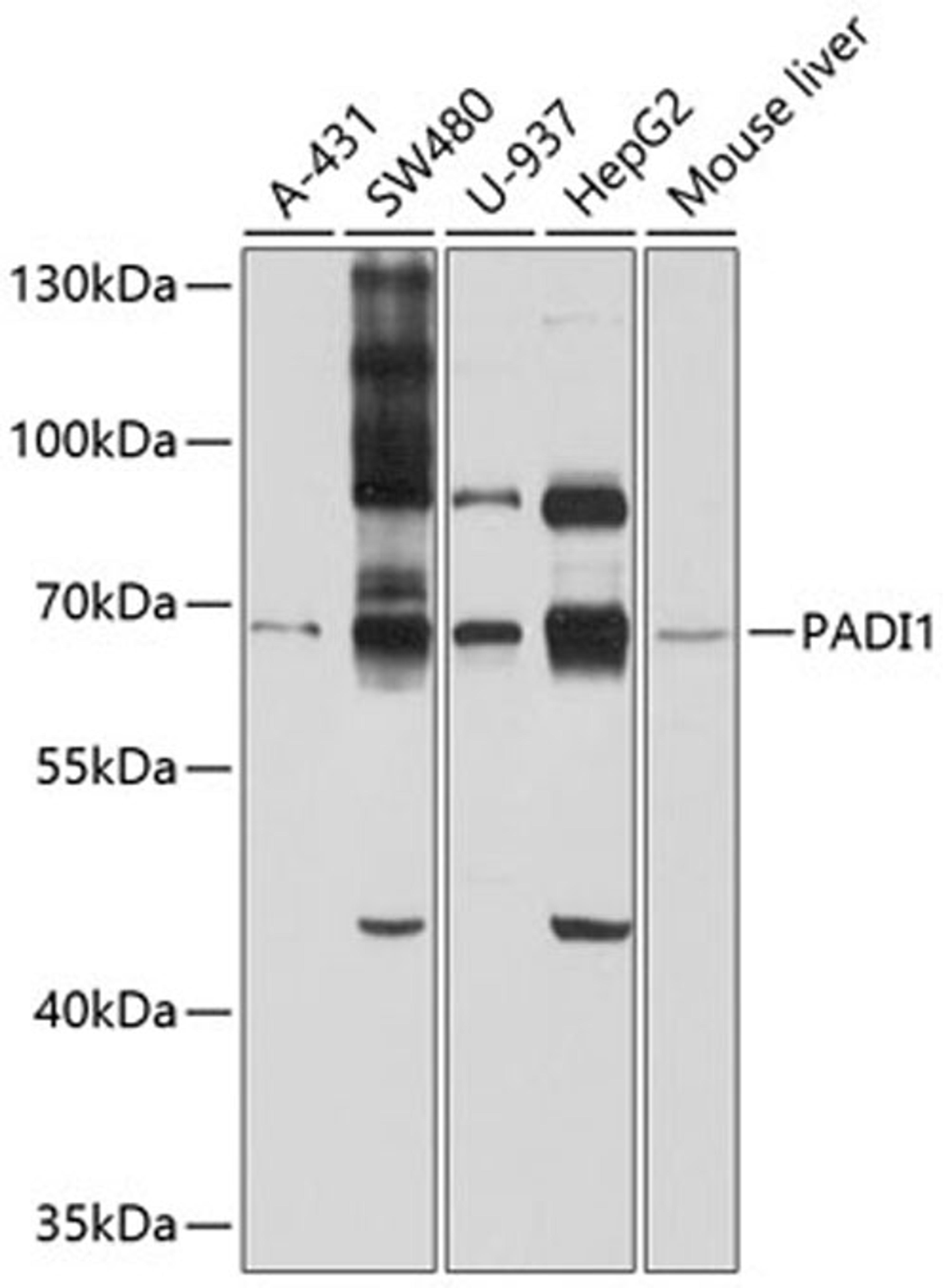 Western blot - PADI1 antibody (A10145)