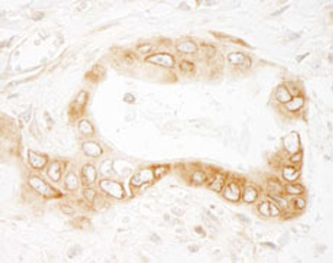 Detection of human UVRAG by immunohistochemistry.