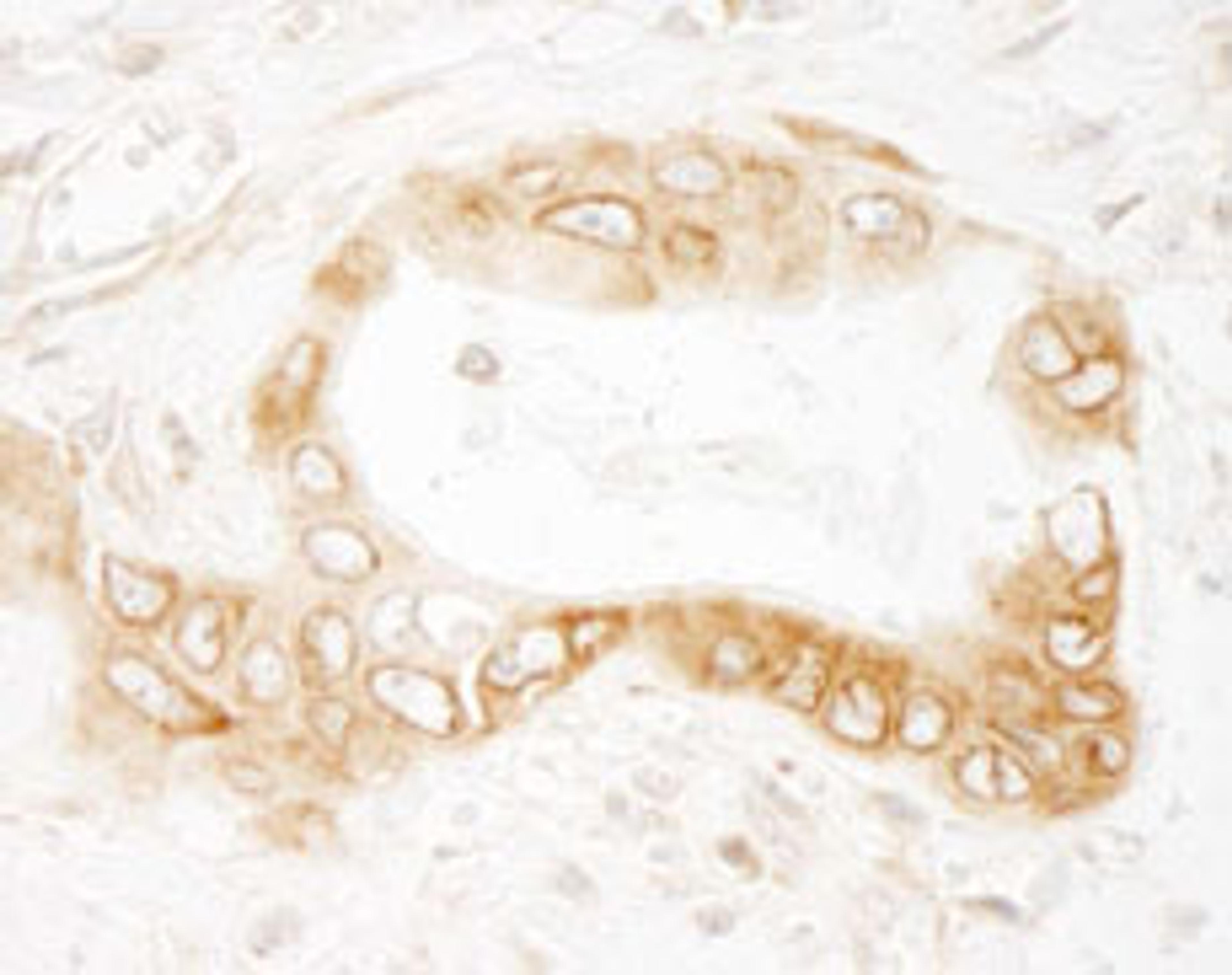 Detection of human UVRAG by immunohistochemistry.