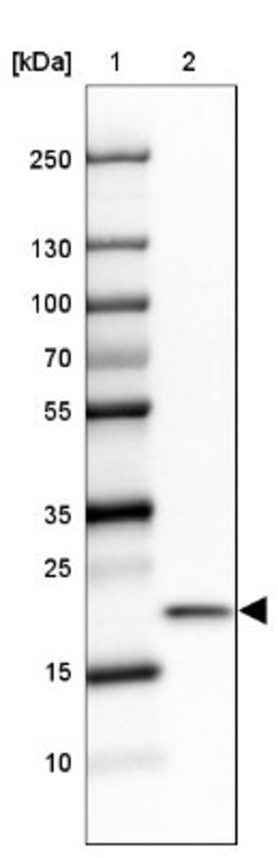 Western Blot: Ribosomal Protein L24 Antibody [NBP2-33622] - Lane 1: Marker [kDa] 250, 130, 100, 70, 55, 35, 25, 15, 10<br/>Lane 2: SK-MEL-30