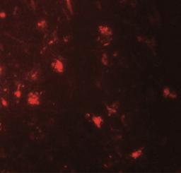 Immunocytochemistry/Immunofluorescence: IL-36 alpha/IL-1F6 Antibody [NBP2-41238] - Immunofluorescence of IL-36A in human brain tissue with IL-36A antibody at 20 ug/mL.